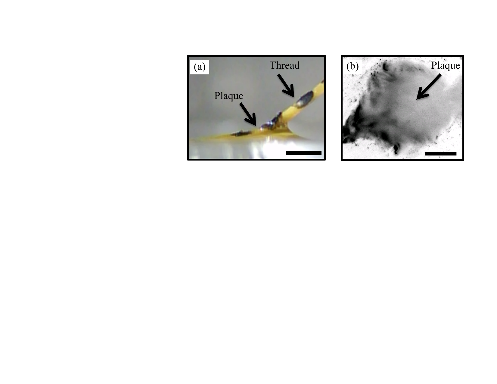 Side view of thread-plaque holdfast under tension