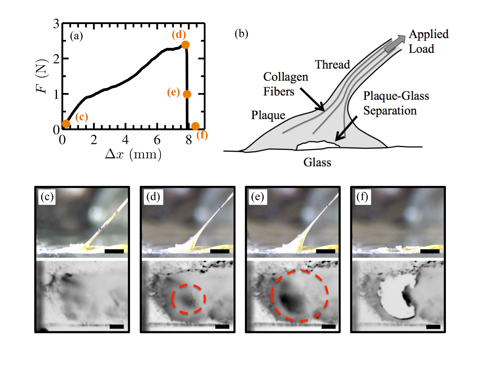 Side view sequence of plaque detachment